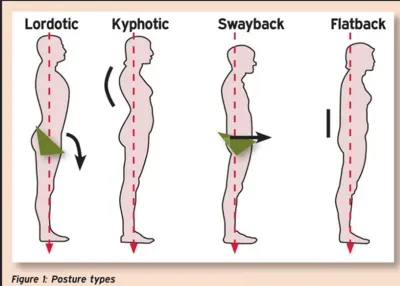 400px-Posture_Types.png