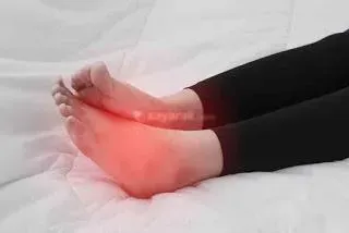 کبد چرب ورم در مچ پا و پاها