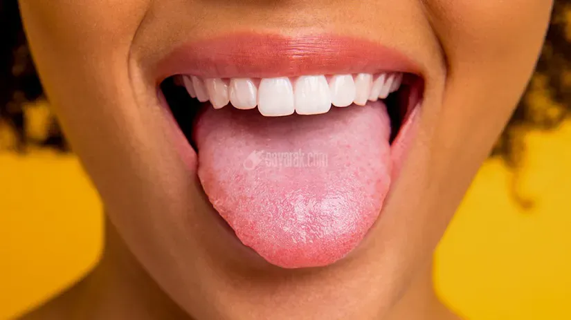 Normal-tongue-out--1296x728-gallery_slide1.jpg
