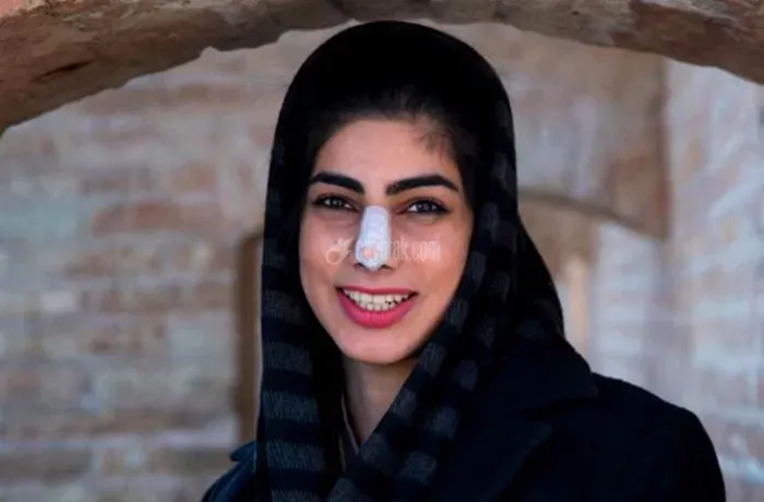 زیبایی زن
